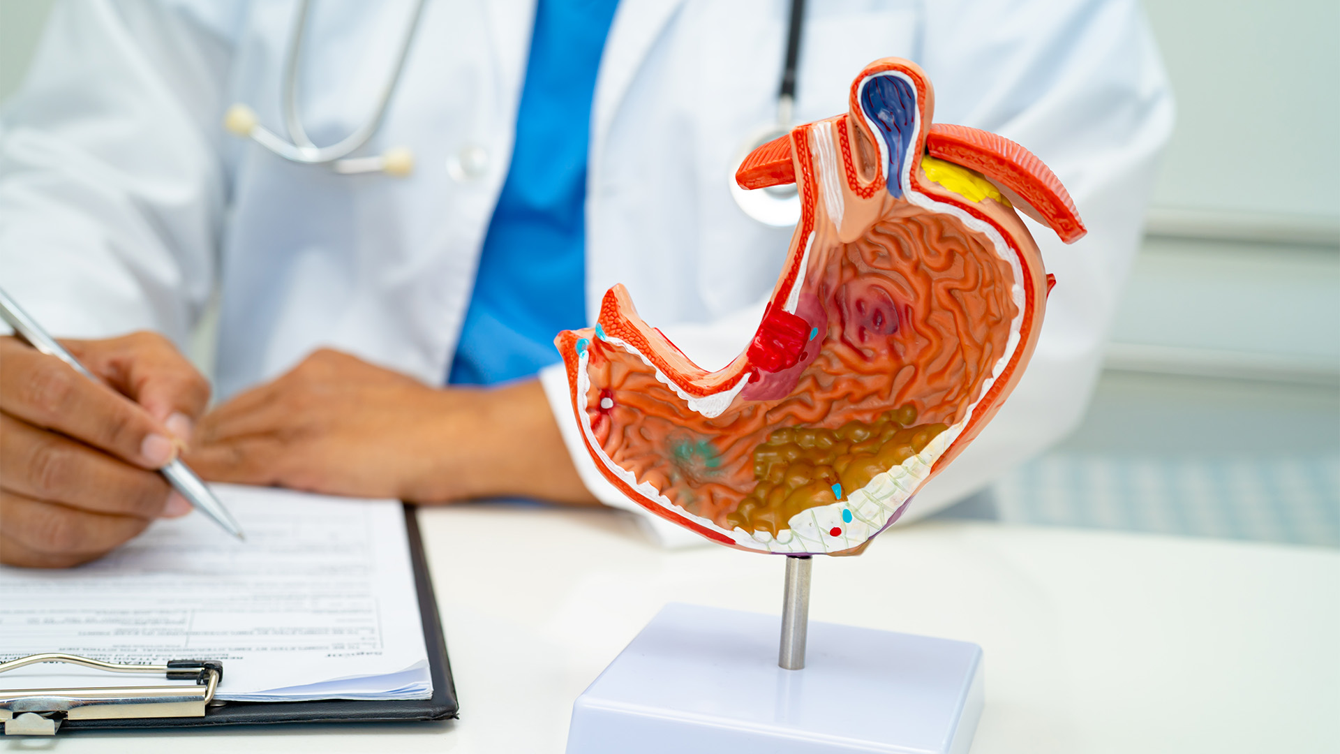 What is the Process of Sleeve Gastrectomy Surgery?